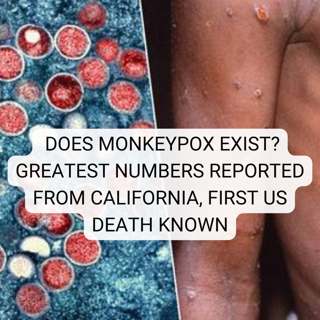 monkeypox exist? greatest numbers reported from California, first US death known