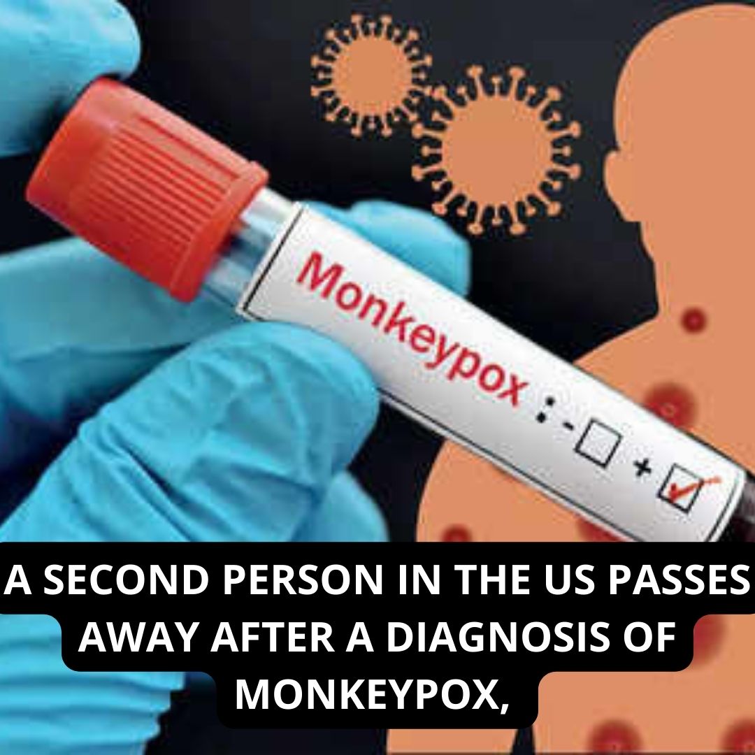 After a diagnosis of monkey pox